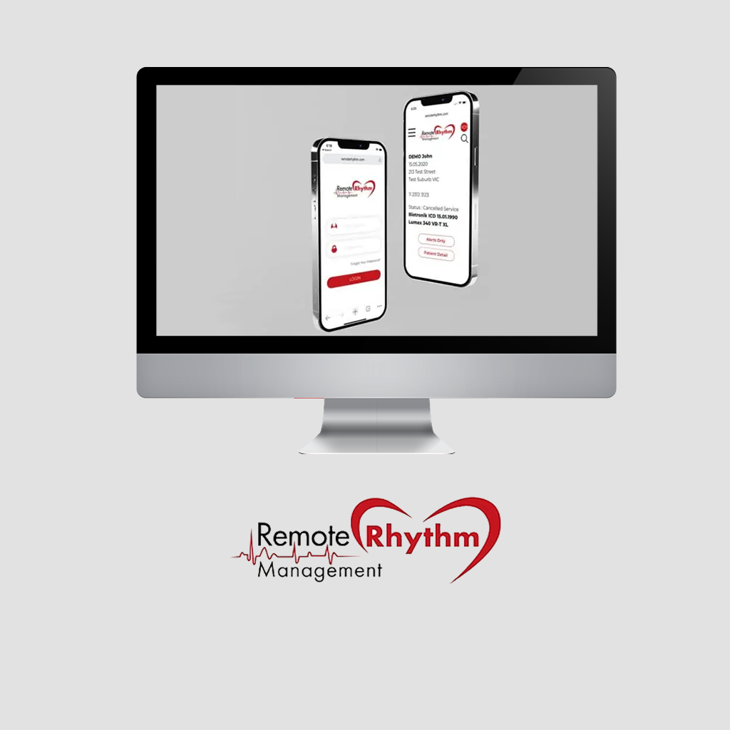 Remote Rhythm